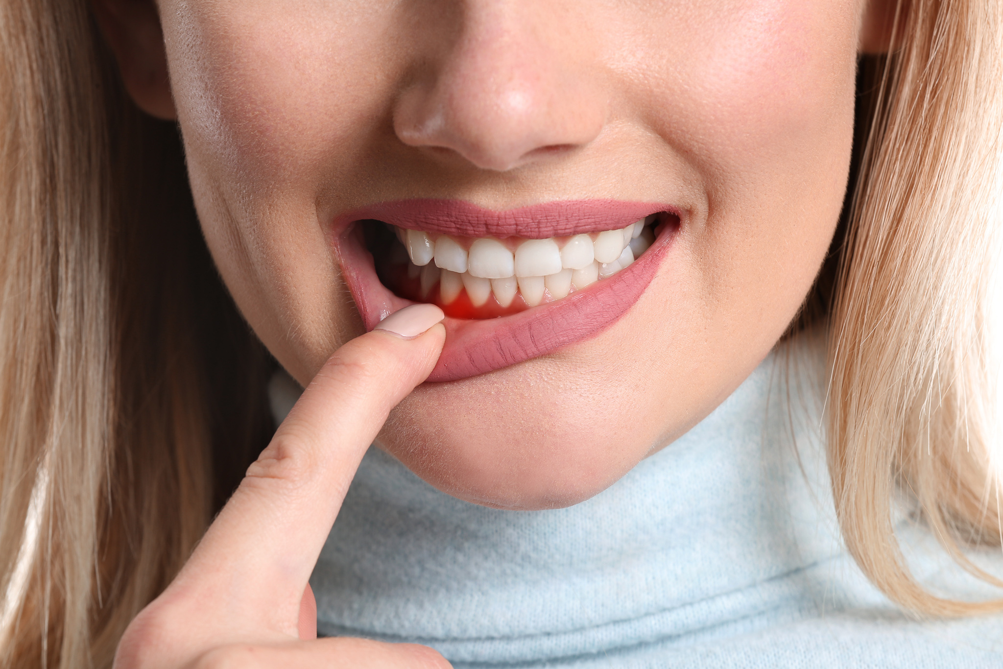 牙周病是什麼？專家超詳細解說牙周病治療方式